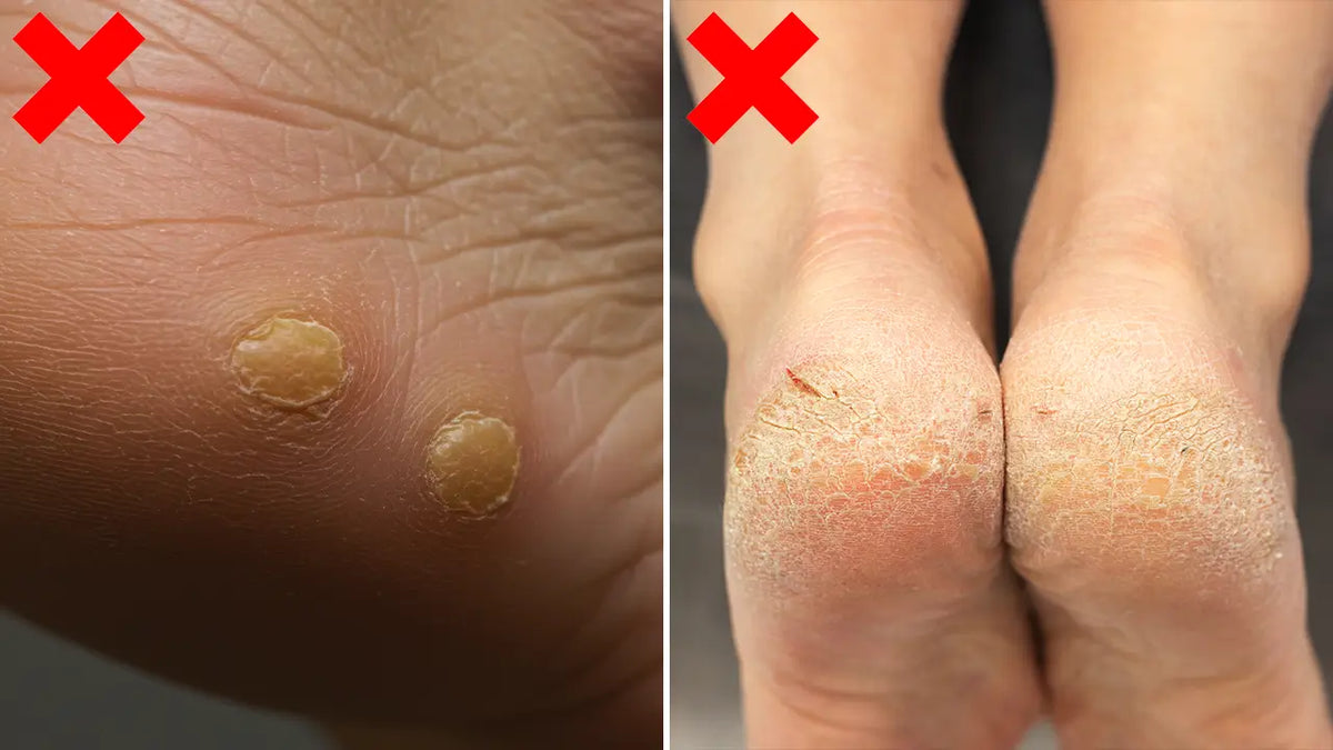 Crème pour les pieds Swissclear