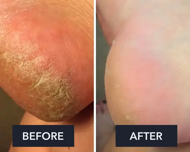 Crème pour les pieds Swissclear