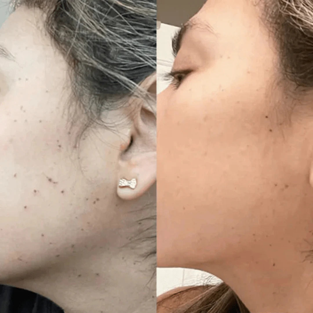 Stylo plasma Swissclear