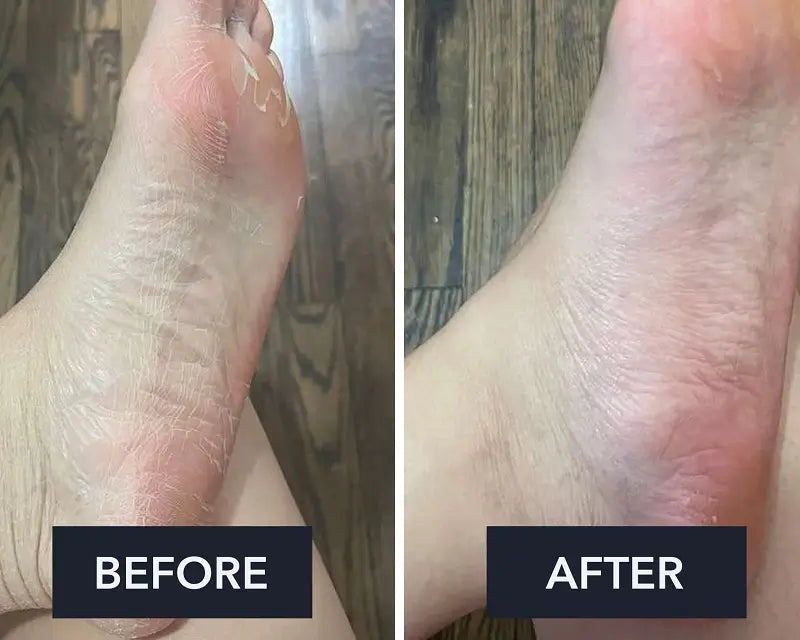 Crème pour les pieds Swissclear