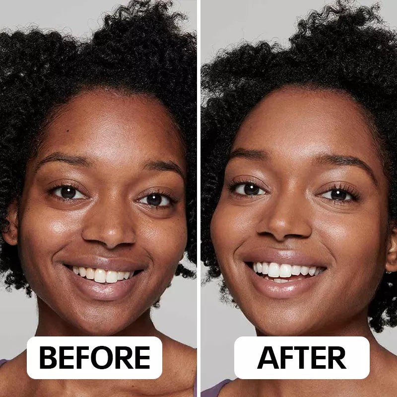 Combiné Neux Radiance™ de Neoclear