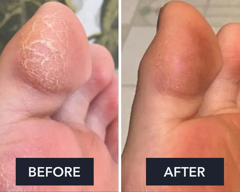 Crème pour les pieds Swissclear