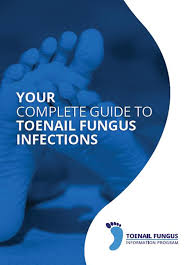 Livre électronique : Guide des mycoses des ongles (Valeur : 14,95 £)