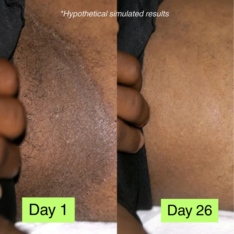 L'Océan - Crème apaisante naturelle pour l'eczéma