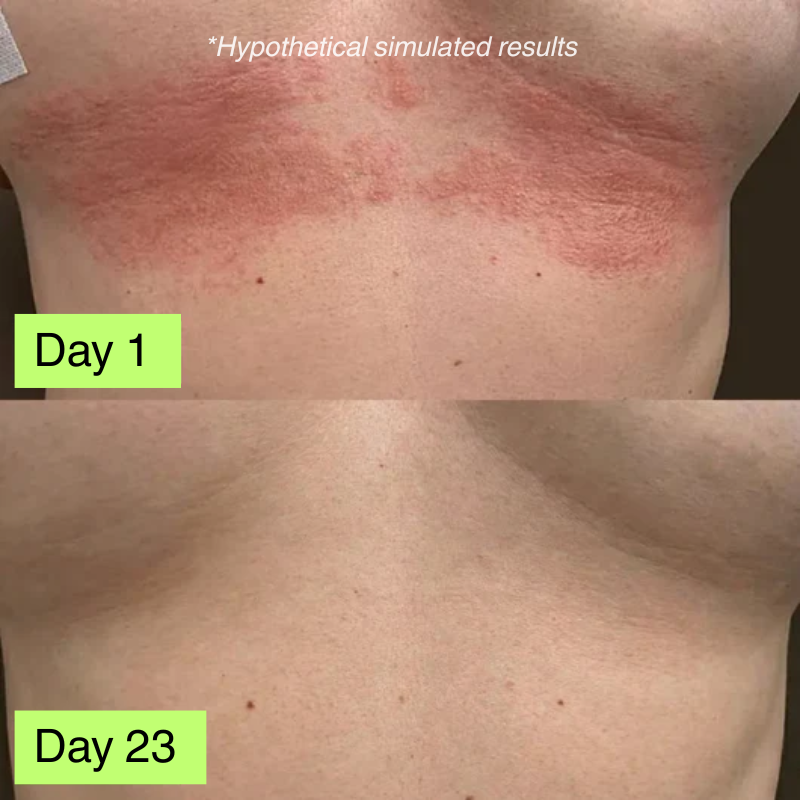 L'Océan - Crème apaisante naturelle pour l'eczéma