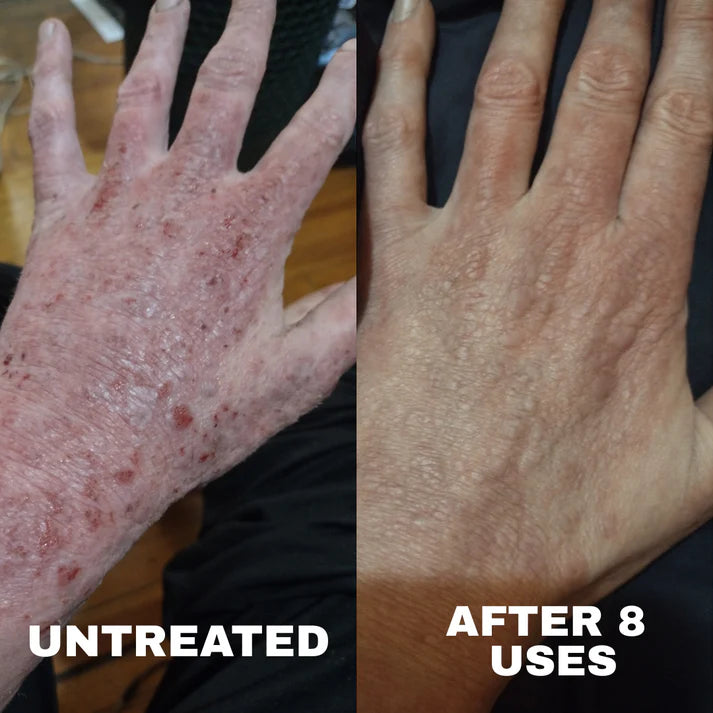 L'Océan - Crème apaisante naturelle pour l'eczéma