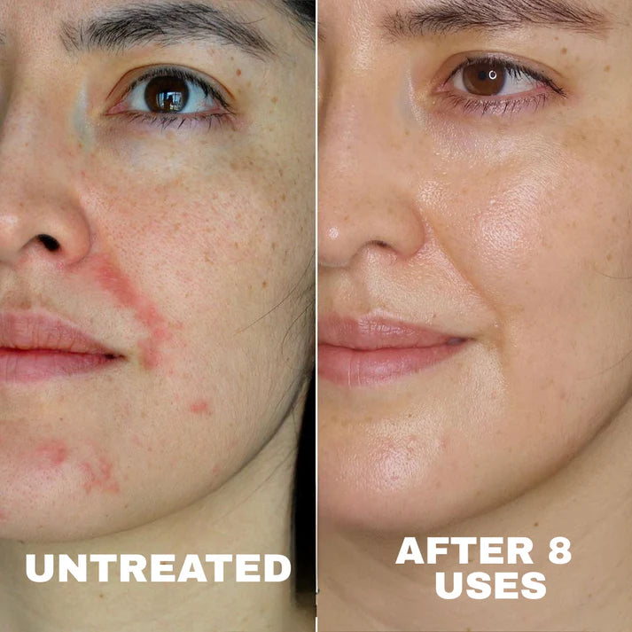 L'Océan - Crème apaisante naturelle pour l'eczéma