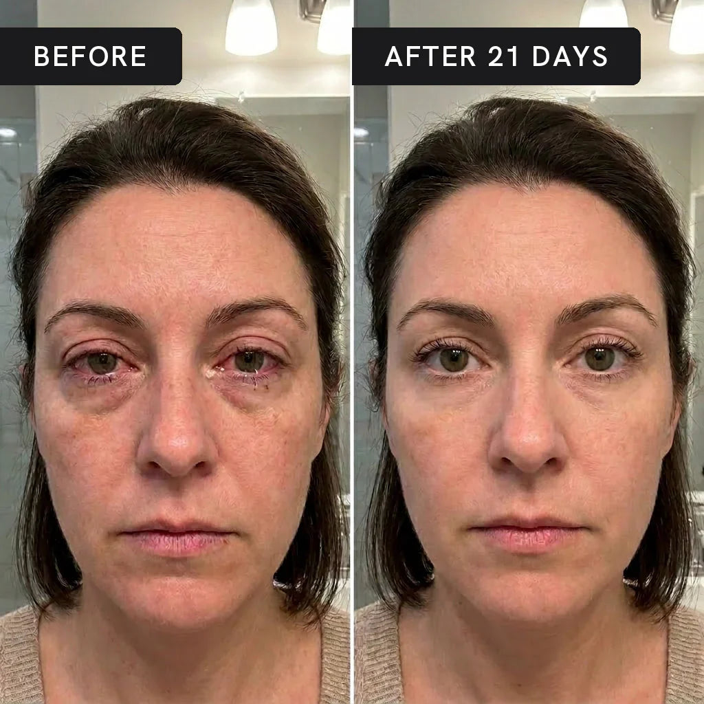 Swissclear Steam Therapy Pro