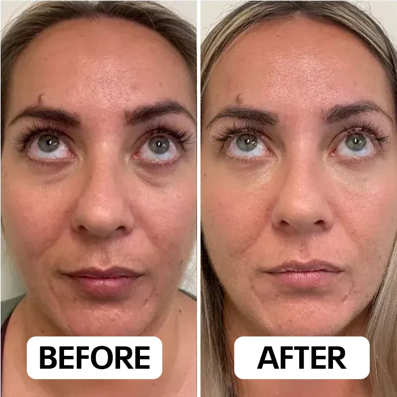 Combiné Neux Radiance™ de Neoclear