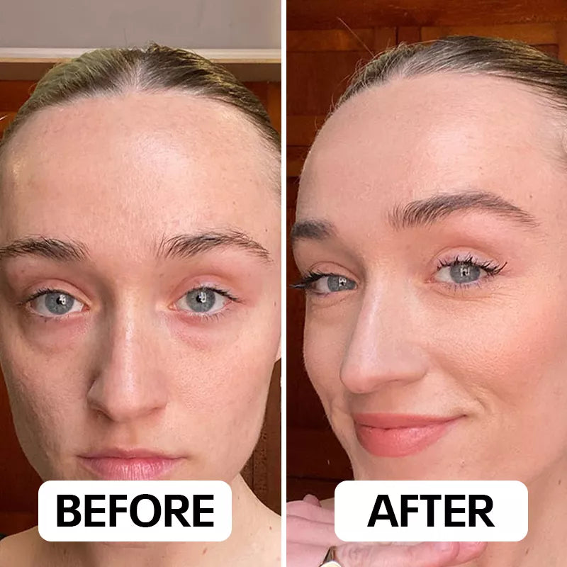 Combiné Neux Radiance™ de Neoclear